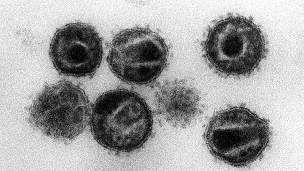 Elektronenmikroskopische Aufnahme mehrerer HIV (Humane Immunschwäche-Viren) Erreger der Immunschwäche-Krankheit Aids.