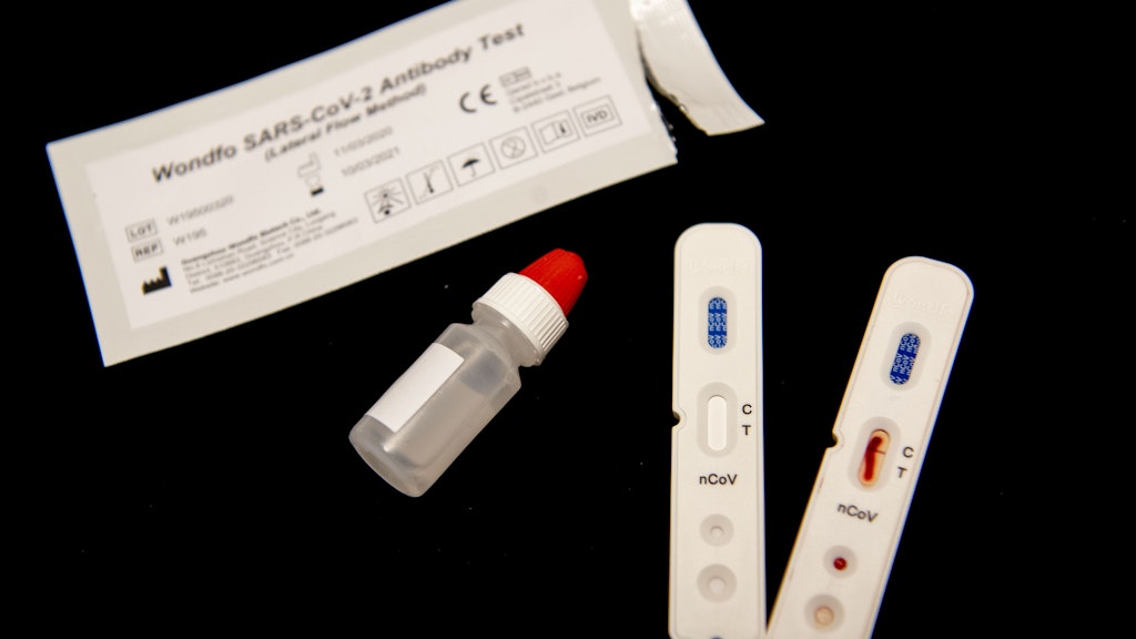 Dieser Schnelltest aus den Niederlanden erinnert an einen Schwangerschaftstest. Er erkennt aber, ob Anti-Körper gegen Corona im Blut vorhanden sind. 
