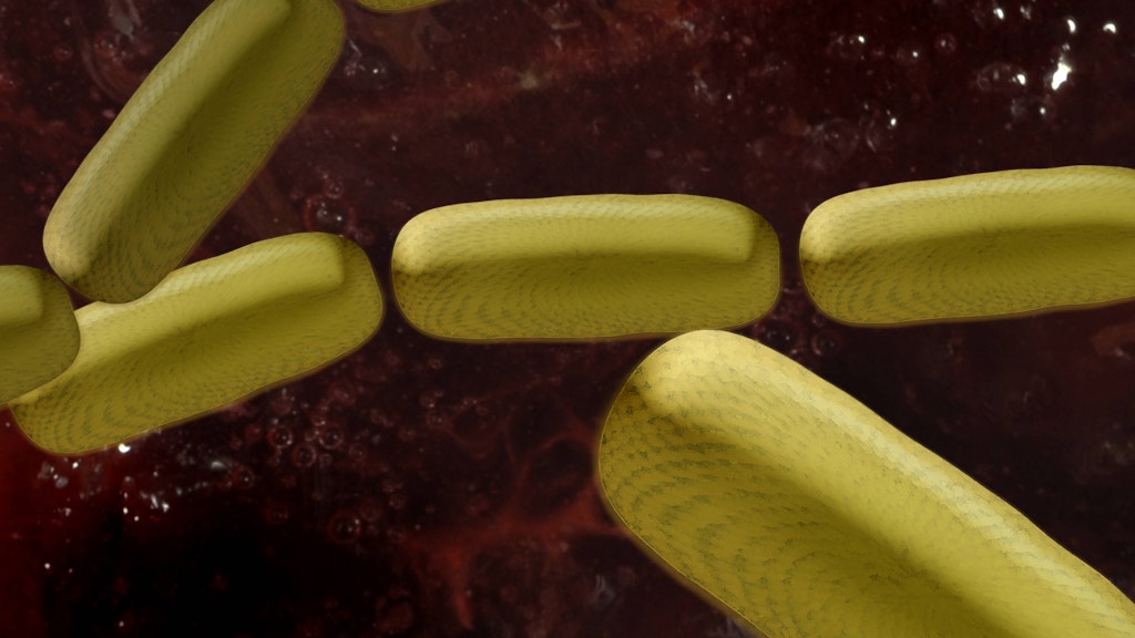 Die Studie konte den Einfluss eines bestimmten Bakteriums, namentlich pks+E. coli, auf den Darm nachweisen. 