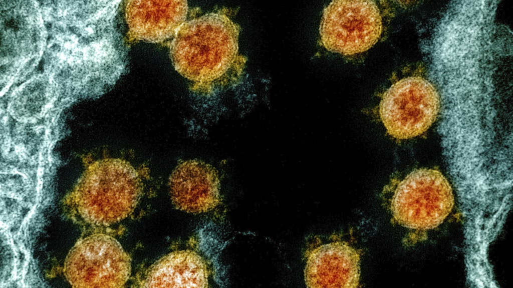 Coronavirus SARS-CoV-2 unter einem Elektronenmikroskop.