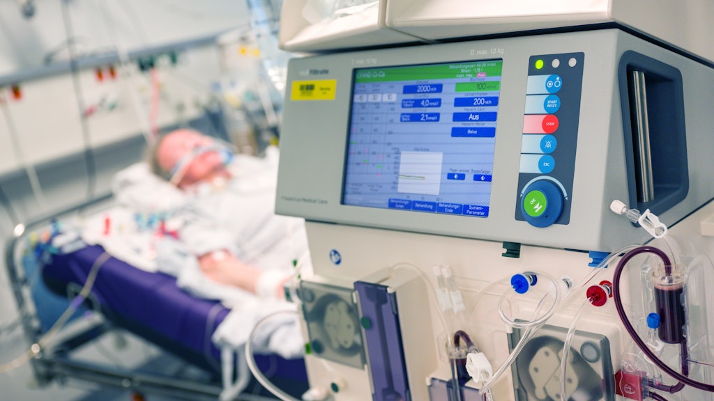 Patient auf der Intensivstation.