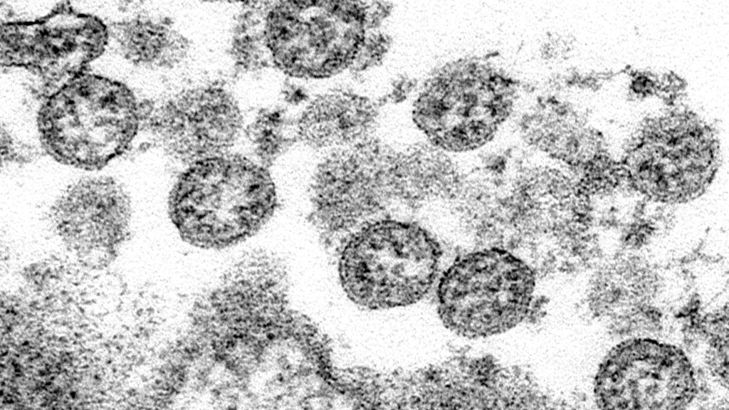 Ein echtes Foto des Coronavirus.