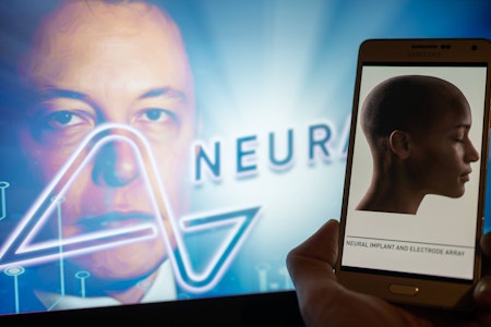 Elon Musks Gehirnchip von Neuralink: Werden die Menschen zu Cyborgs?