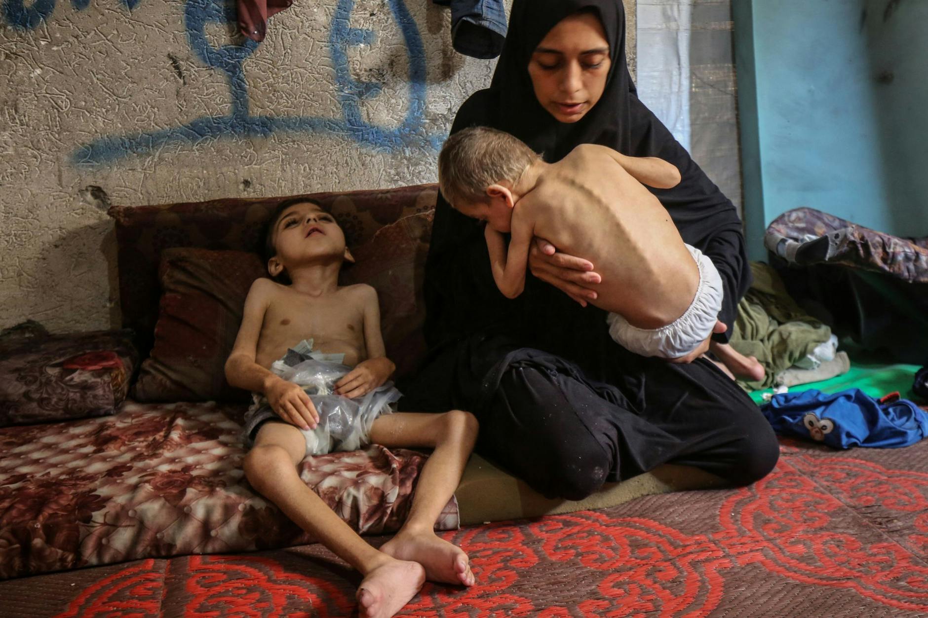 Zwei vertriebene palästinensische Kinder, die an Unterernährung und zerebraler Lähmung leiden, im Nordwesten von Gaza-Stadt in einer zur Schule umfunktionierten Unterkunft.