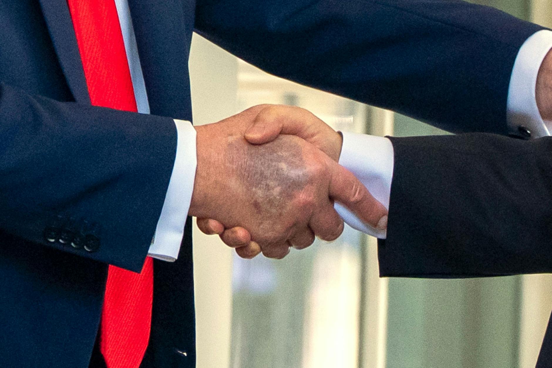 Bei der Begrüßung des südkoreanischen Präsidenten Ende August im Weißen Haus waren auf der Hand von Donald Trump Flecken zu sehen.